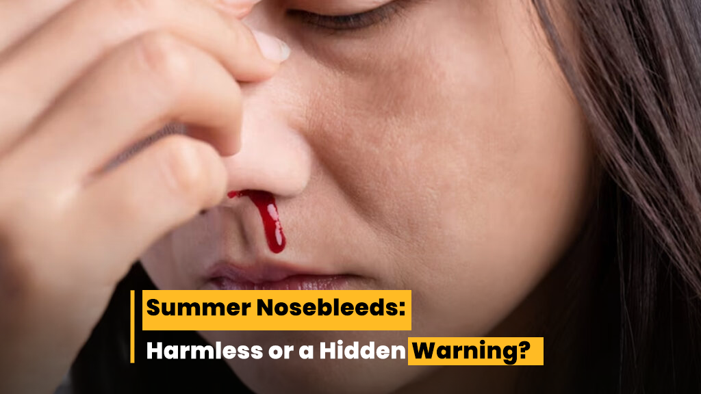 Summer Nosebleeds Harmless or a Hidden Warning