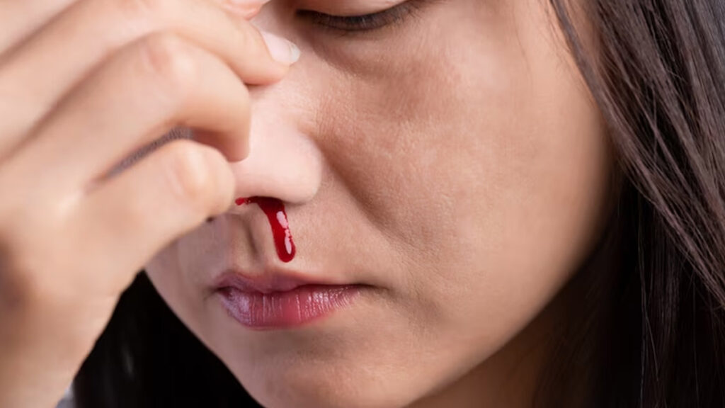 Summer Nosebleeds: A Common Nuisance or a Hidden Warning Sign?