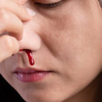 nosebleeding-in-summer-Main